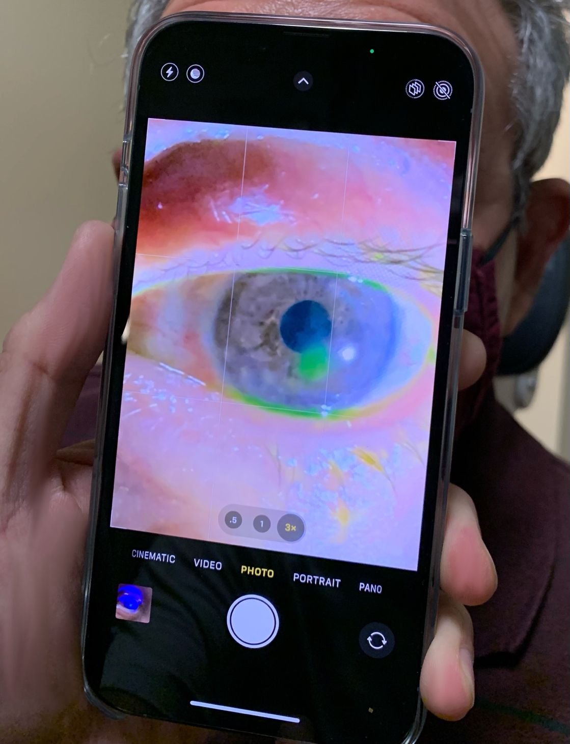 Com o modo fotografia macro, o oftalmologista consegue examinar melhor os pacientes.