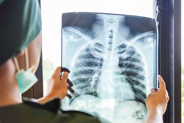 Médica analisa exame de raio-x de tórax de paciente