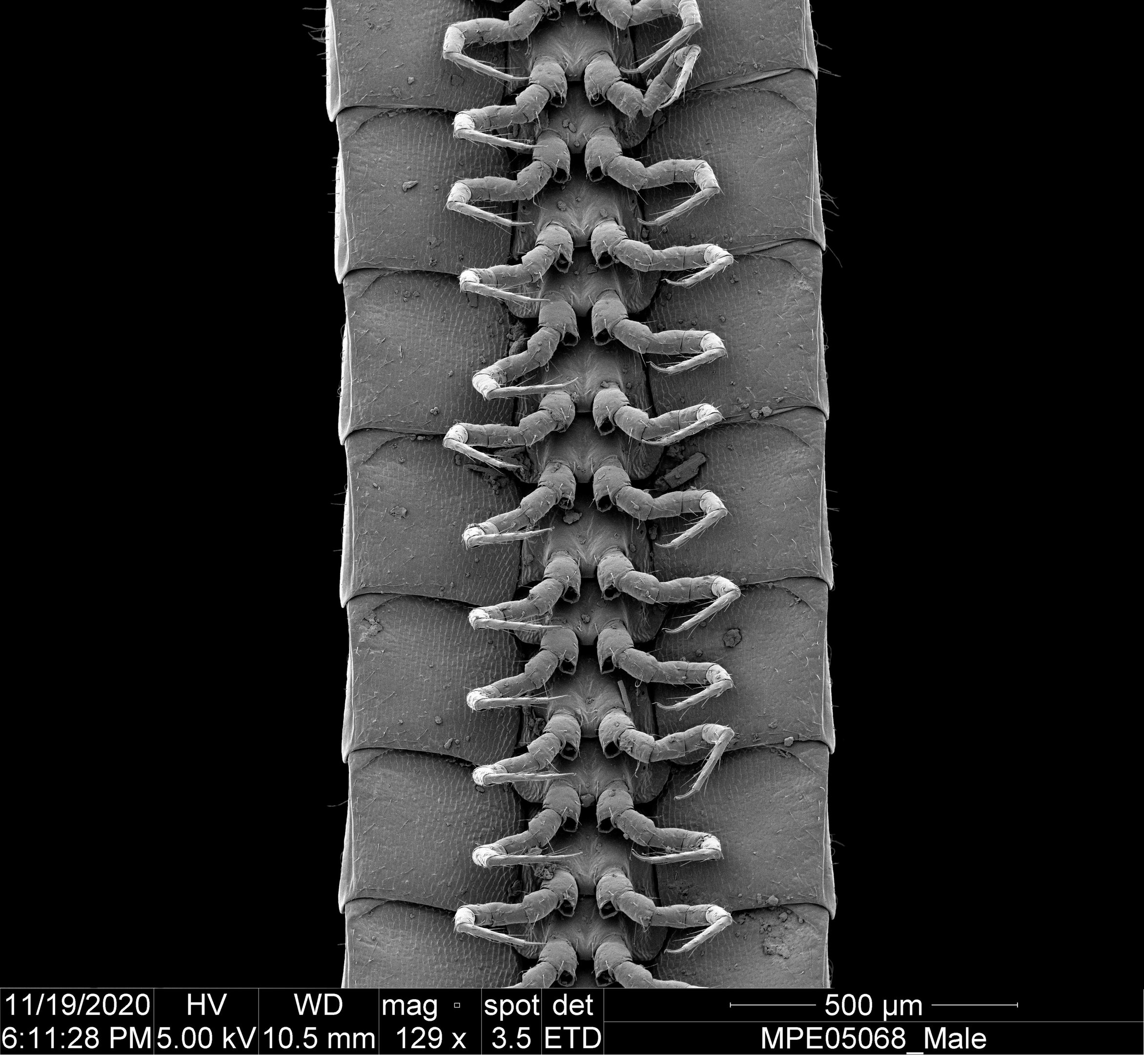 Visão ventral das pernas de um espécime macho da Eumillipes persephone