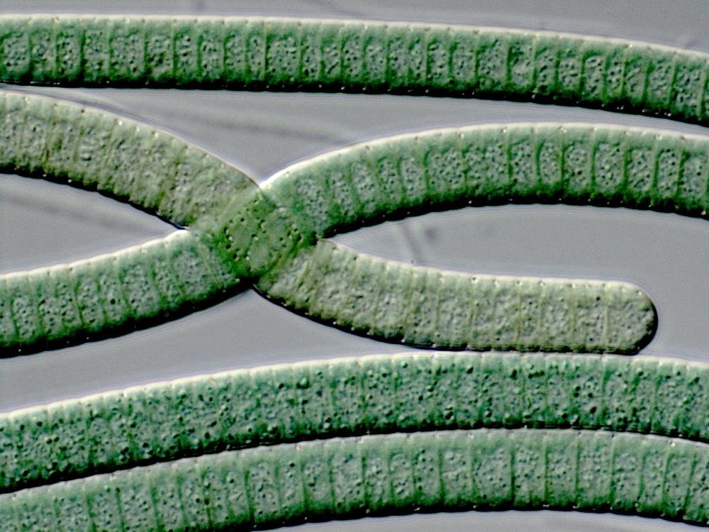 Die größten Bakterien von allen können bis zu 2 cm lang werden