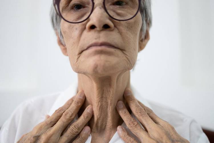 Linfomas podem vir acompanhados de inflação dos gânglios (Fonte: Shutterstock)