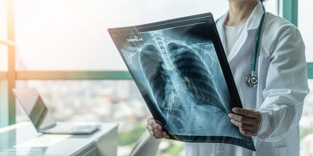 Fibrose cística pode prejudicar o funcionamento dos pulmões
