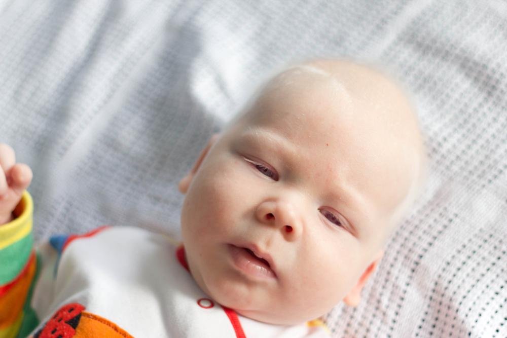 O nistagmo pode aparecer nos primeiros meses de vida (Fonte: Shutterstock)