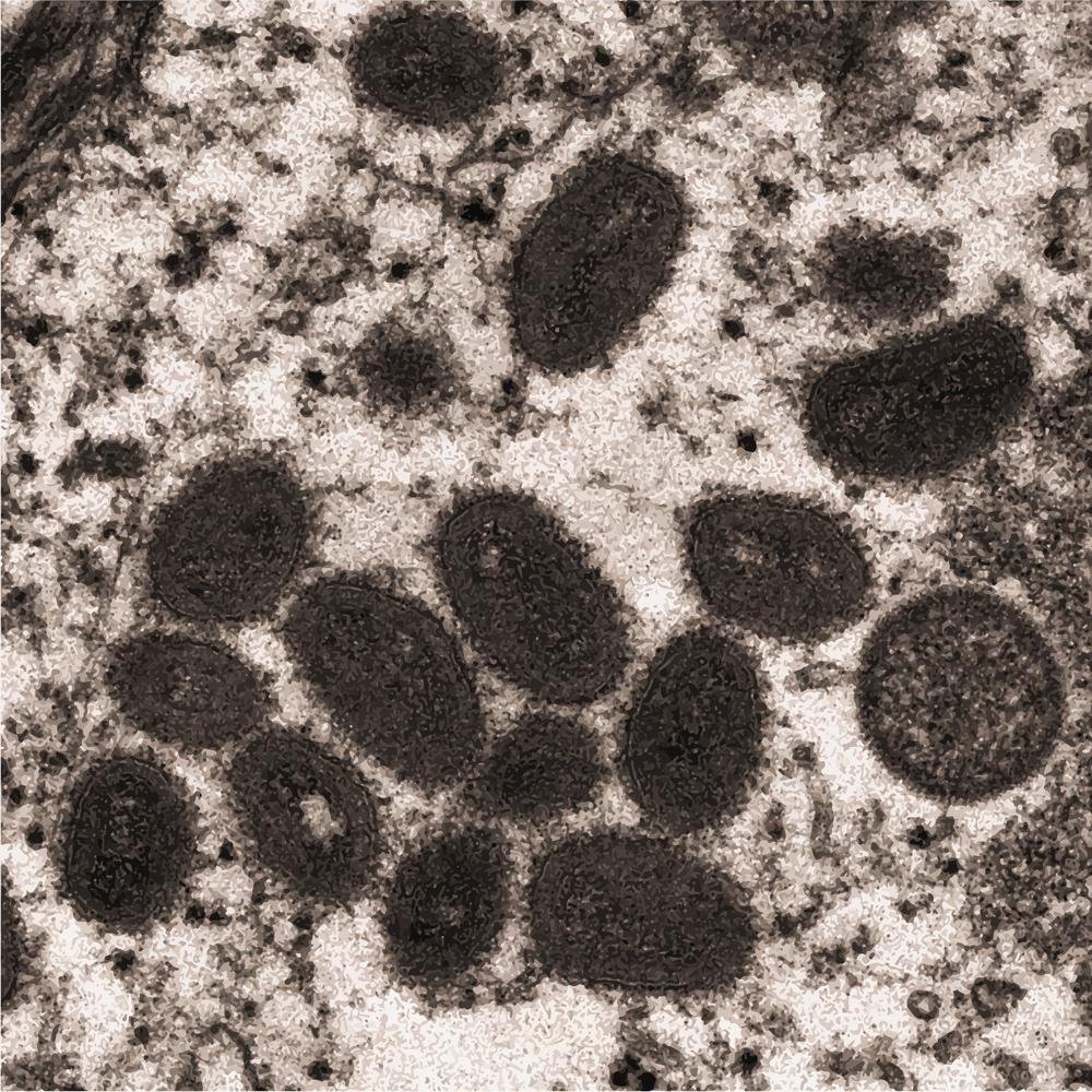 A varíola de macaco é causada por vírus ortopoxvirus (Fonte: Shutterstock)