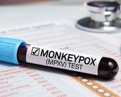 O que sabemos e não sabemos sobre o Monkeypox, a varíola de macaco