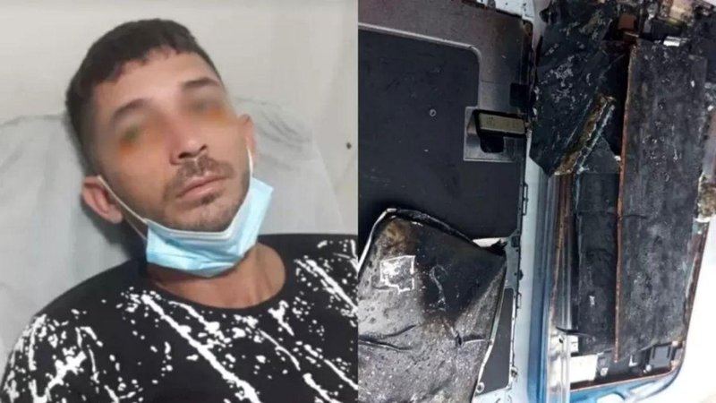 Rosto de Leandro após o acidente