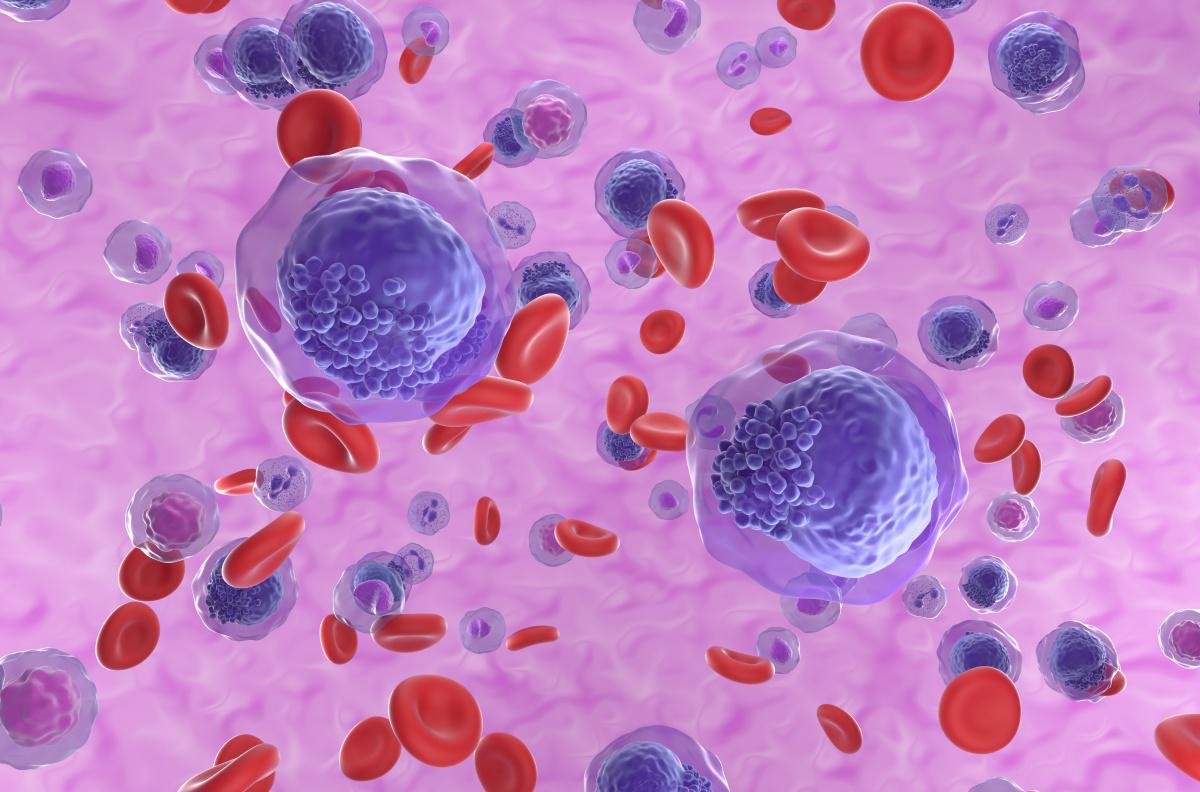 Leucemia é uma doença relacionada aos glóbulos brancos do sangue