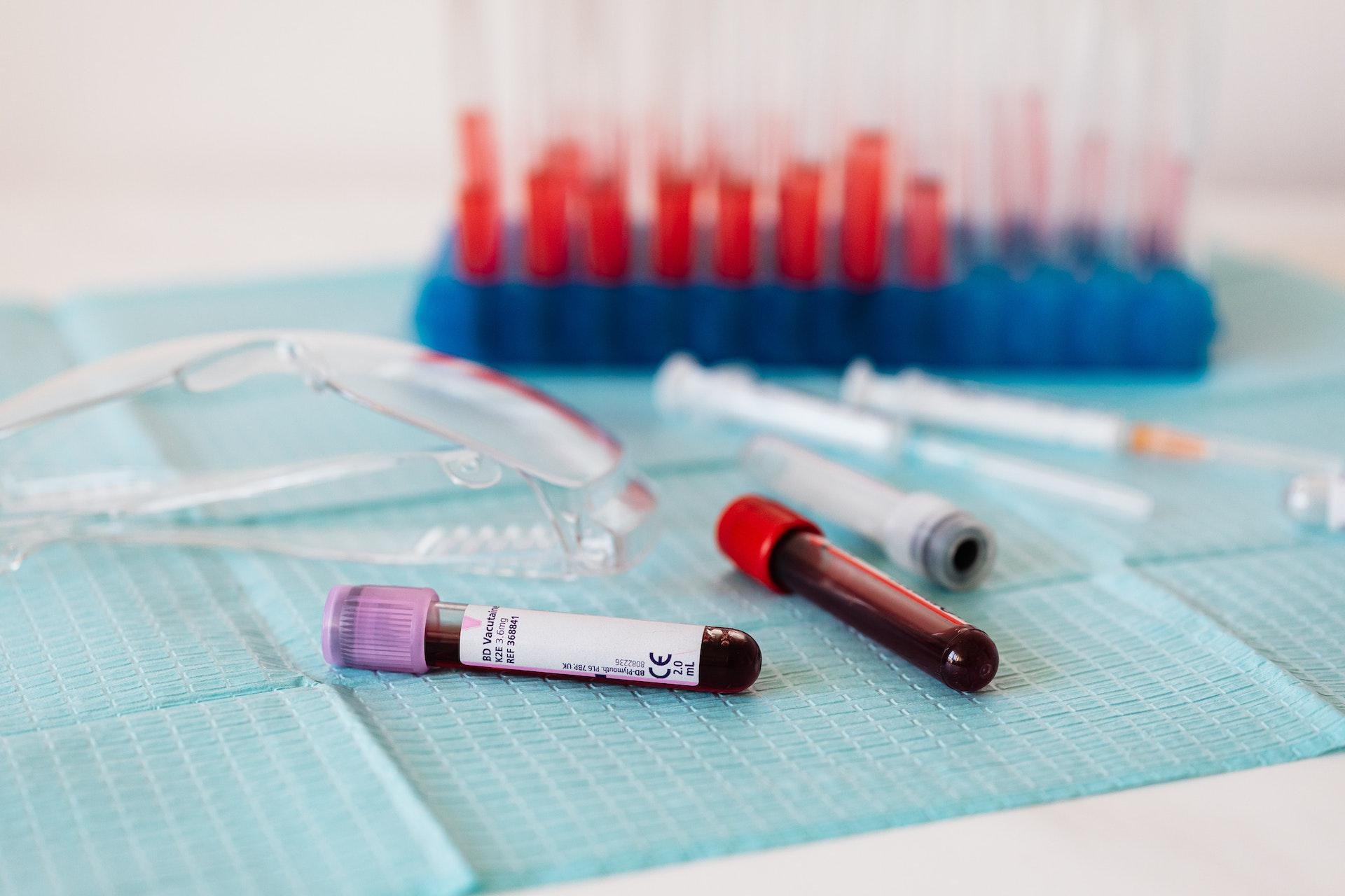 O vírus pode ser encontrado em exames de sangue (Fonte: Pexels/Karolina Grabowska)