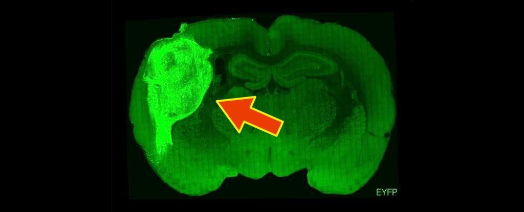 Organoide humano (marcado com proteína fluorescente) em cérebro de rato. (Fonte: Universidade de Stanford/Divulgação.)