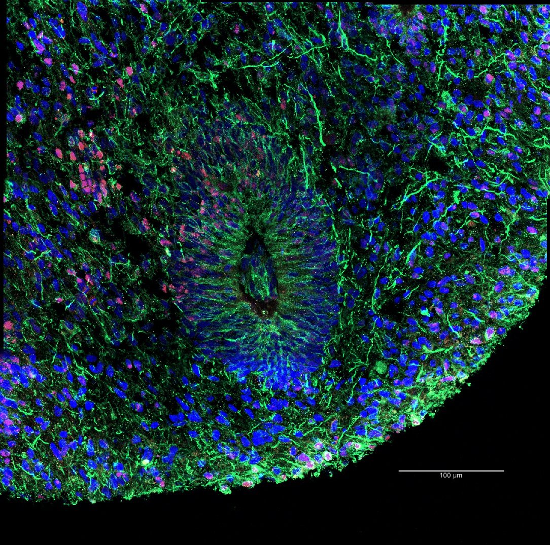 Minicérebro visto no microscópio; organoide foi produzido por pesquisadores da Unicamp