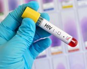 HIV: os avanços e gargalos para 2023