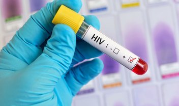 HIV: os avanços e gargalos para 2023