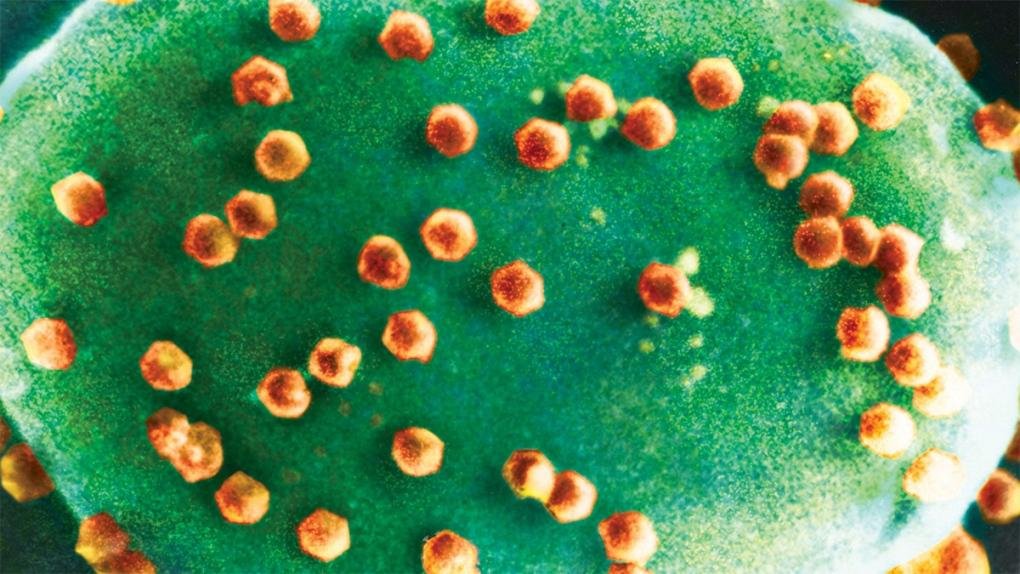 Clorovírus atacando uma alga em imagem de microscópio. (Fonte: Kit Lee/Angie Fox/Universidade do Nebraska-Lincoln/Reprodução.)