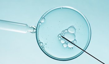 Fertilização In Vitro: entenda como funciona e quem pode fazer