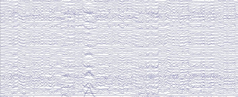 Atividade cerebral de um participante do estudo, registrada em várias localidades do couro cabeludo pelo eletroencéfalograma