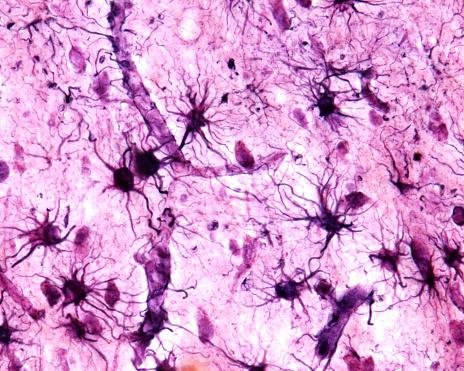As células da glia fazem suporte, proteção e nutrição dos neurônios.
