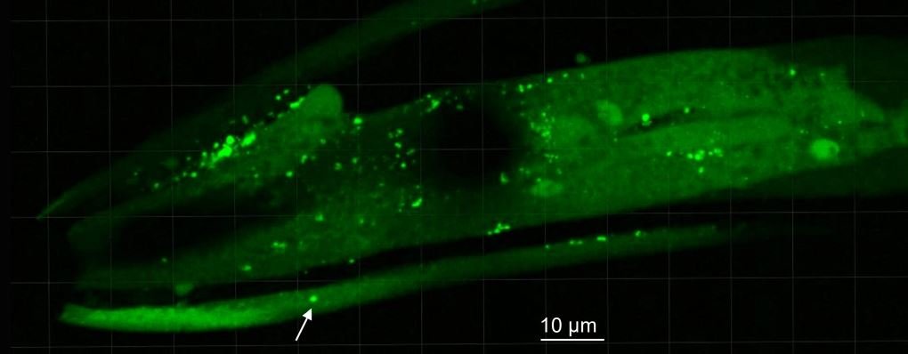 Os potinhos destacados na imagem indicam a presença de aglomerados de uma proteína neural causada pelo Parkinson, em testes realizados em vermes.