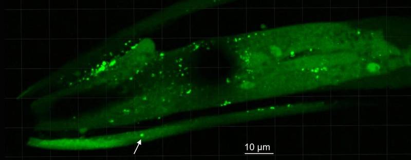 Os potinhos destacados na imagem indicam a presença de aglomerados de uma proteína neural causada pelo Parkinson, em testes realizados em vermes.