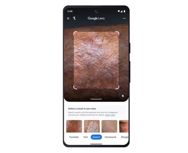 O Google Lens pode funcionar como um "dermatologista virtual".
