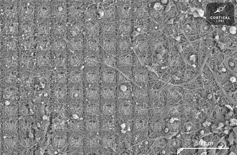 Imagem microscópica do DishBrain apresentando neurônios crescendo em uma matriz de eletrodos; o projeto recebeu o investimento do Programa Nacional de Bolsas de Pesquisa de Inteligência e Segurança da Austrália.