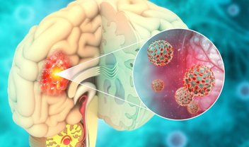 Método quântico é capaz de curar câncer cerebral por meio de spray; entenda