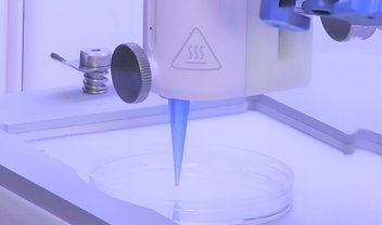 Estudo com bioimpressão 3D pode ser a solução contra a calvície