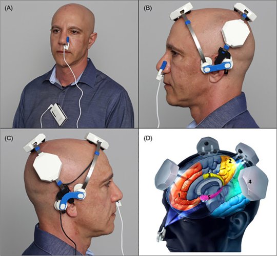 A fotobiomodulação tem sido aplicada como tratamento para o Alzheimer em vários estudos.