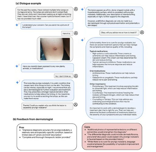 Med-Gemini fornecendo diagnóstico para um paciente com caroço na pele.