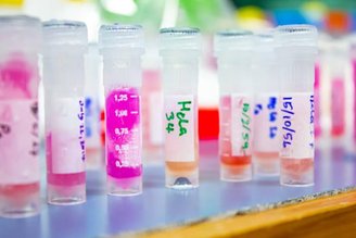 Gey had been trying to grow human cell lines for study purposes for some time, but was unsuccessful.