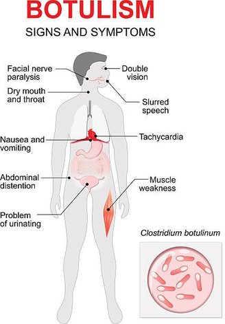 Pay attention to the signs and seek medical help immediately. Source: GettyImages.