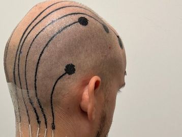 Cyberpunk 2077? Conheça as 'tatuagens eletrônicas' desenvolvidas por cientistas para diagnosticar doenças