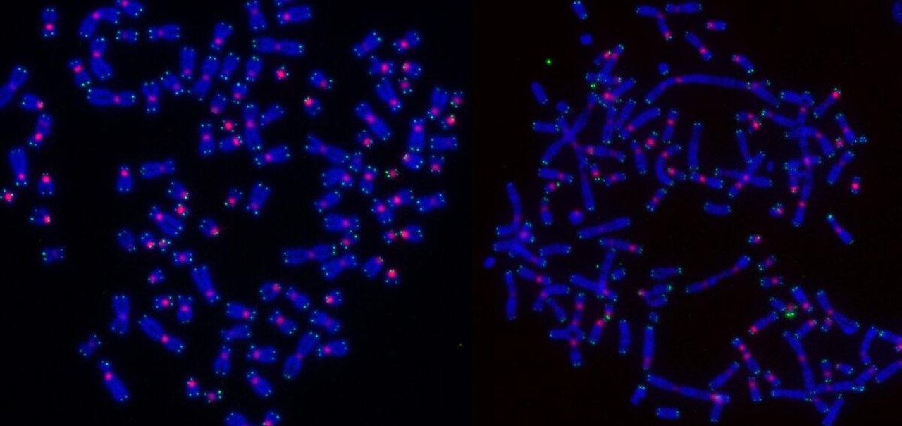 Por que algumas células cancerosas resistem à radioterapia? Estudo explica