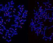 Por que algumas células cancerosas resistem à radioterapia? Estudo explica