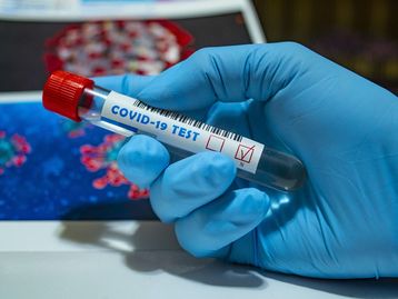 Vazamento de laboratório? CIA muda posicionamento a respeito da origem da covid-19