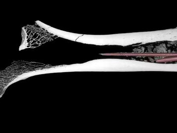 Veneno de flecha mais antigo do mundo é achado dentro de osso de 7 mil anos