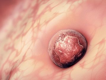 O que é microquimerismo fetal?