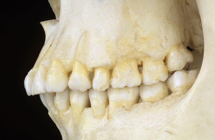 cranio-dentes.jpg