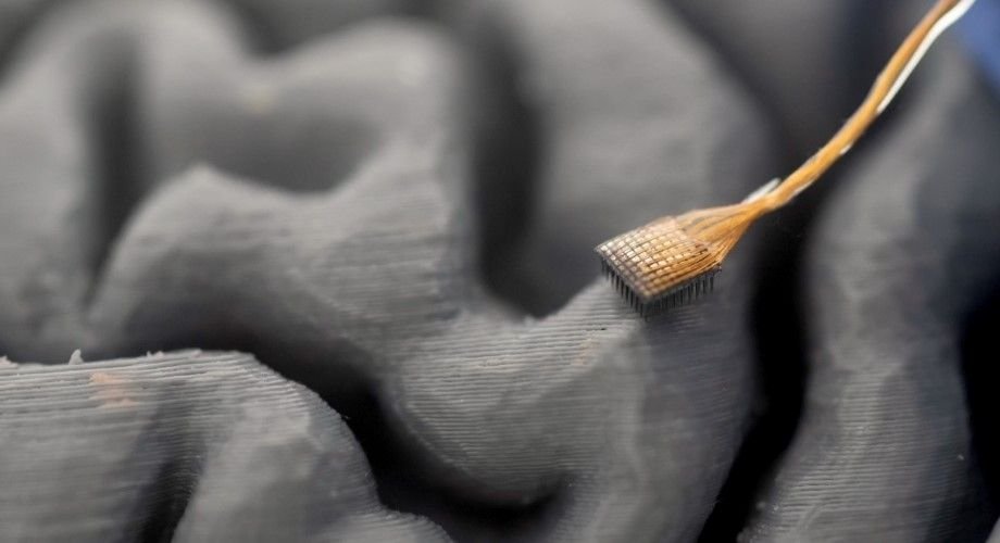 Paciente com doença neurológica volta a 'falar' após implante de chip cerebral