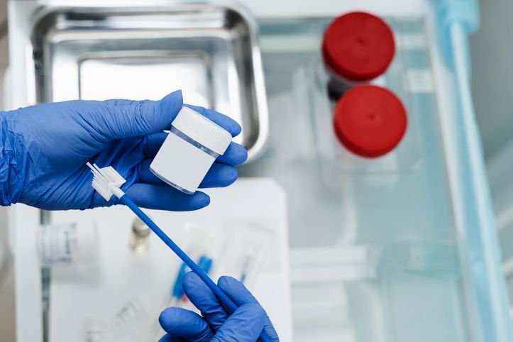 Novo exame gratuito para detectar vírus do HPV já está disponível no SUS Um novo exame para detectar o papilomavírus humano (HPV), principal causador do câncer de colo de útero, começou a ser oferecido gratuitamente nas unidades do Sistema Único de Saúde (SUS) de vários estados, este mês. O método vai substituir gradativamente o papanicolau, em todo o Brasil, segundo o Ministério da Saúde. frasco-para-coleta-de-exame-papanicolau