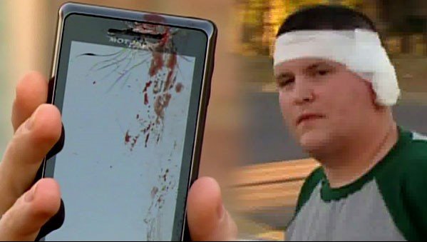 Rapaz machucado pela explosão de Motorola Droid